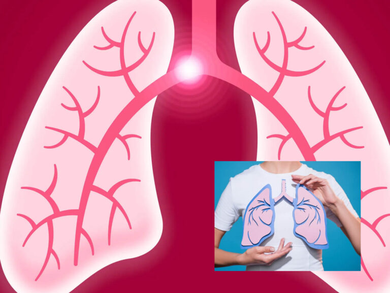 Lungenembolie: Wie schnell stirbt man? Symptome, Risiken und Behandlung wie schnell wachsen haare